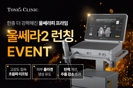 팝업